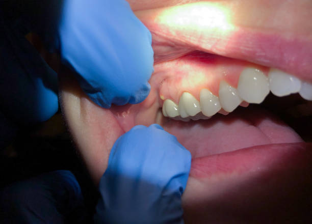 Best Orthodontic Emergency Dentist in Alanes Ridge, CA