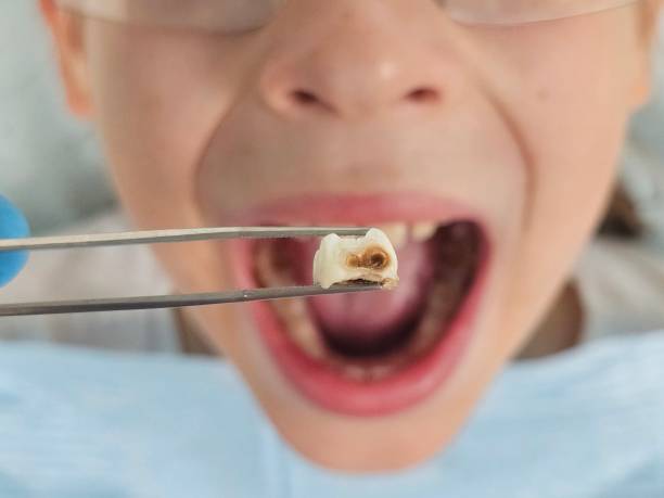 Best Weekend Emergency Dentist in Alanes Ridge, CA